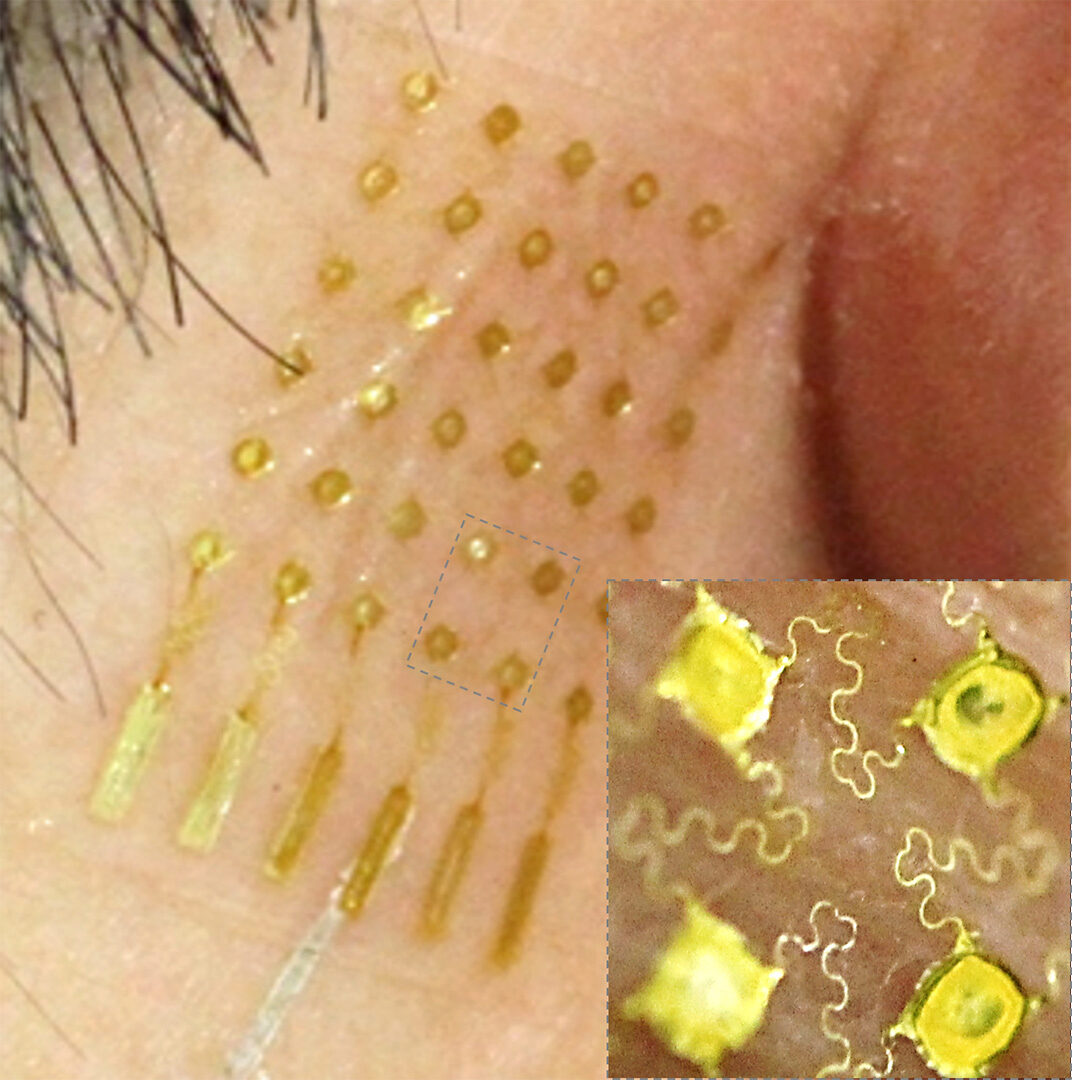 An aerosol-jet printed stretchable, skin-like electrode with an open-mesh structure shown in inset. (Courtesy of Woon-Hong Yeo)