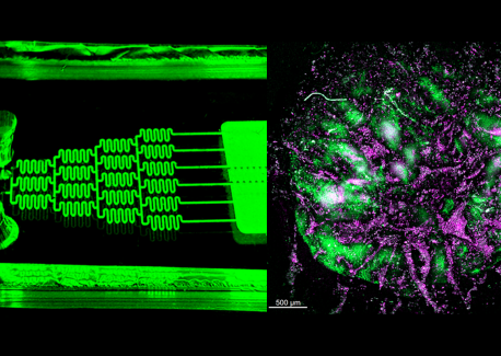 The left image shows the immune organ-on-chip, where the organoids (right) are grown to study the response of human donors. The right image shows development of types of immune cells relevant to the antibody response.